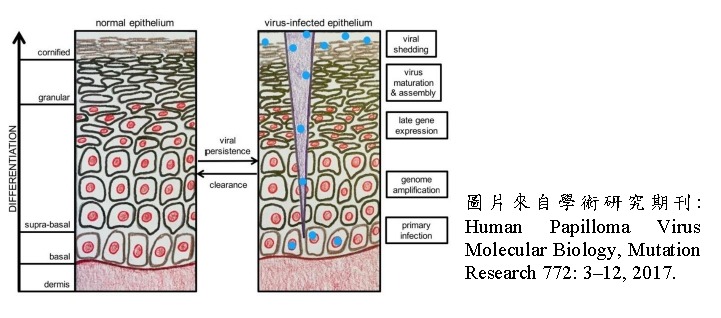 HPV 發病機轉示意圖